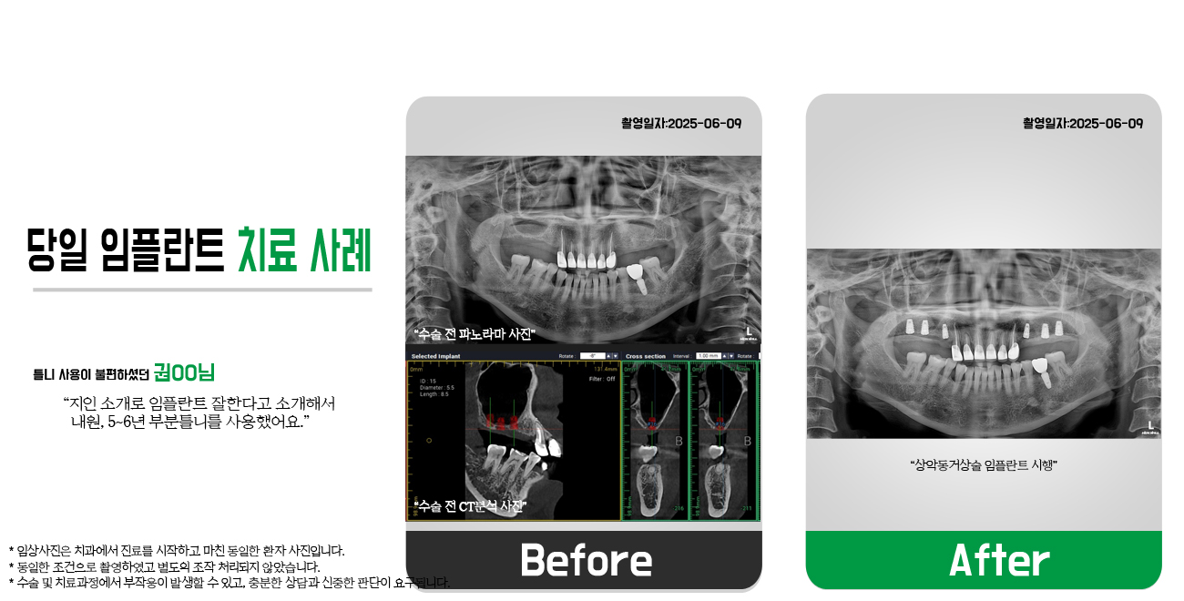 광진정플란트치과 메인 비주얼 2
