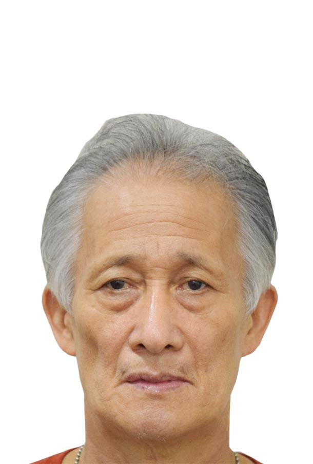 환자 치료 전 사진